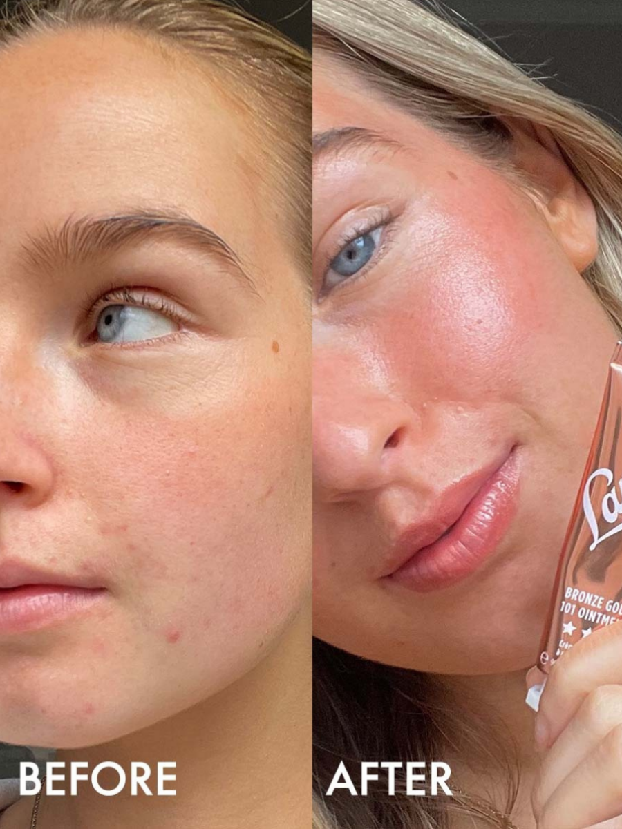 Bronze Gold Before & After