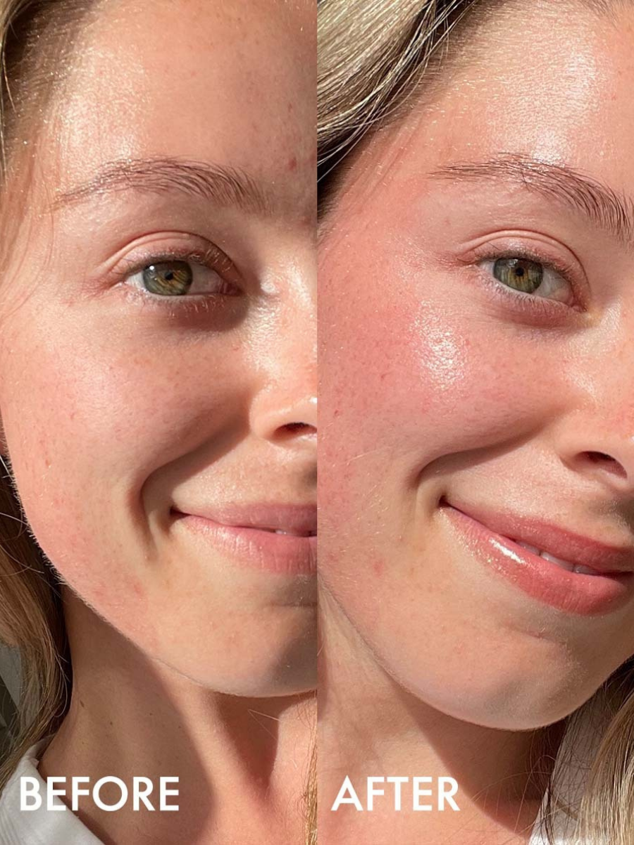 Bronze Gold Before & After
