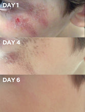 Before & After of Child's Graze using Golden Dry Skin Miracle Salve