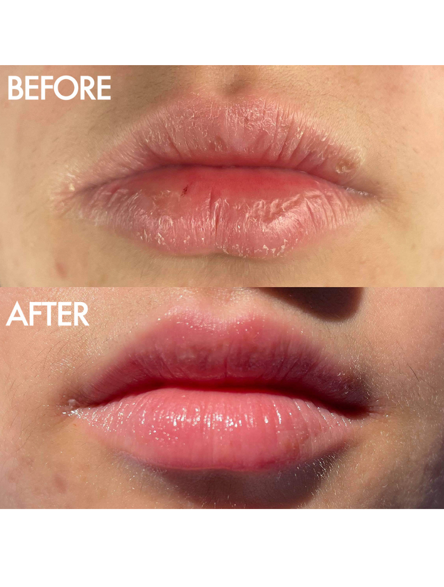 Before & Afters