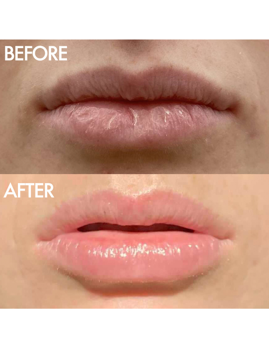 Before & Afters