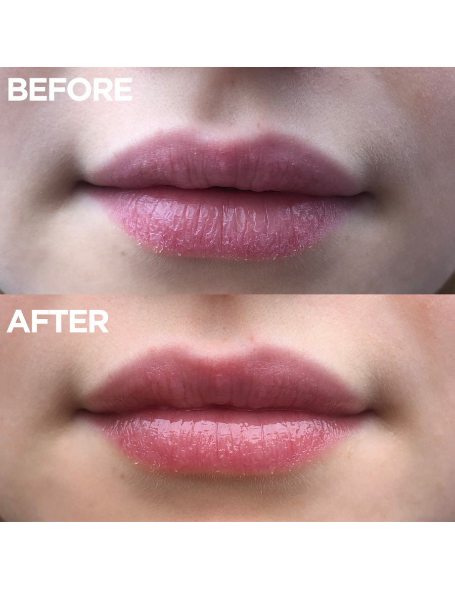 Before & Afters