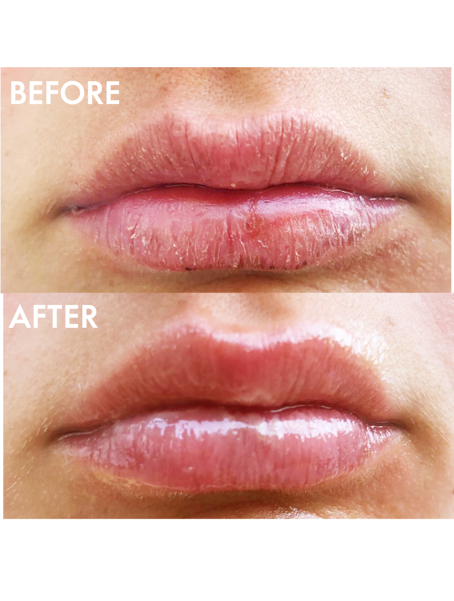 Before & Afters