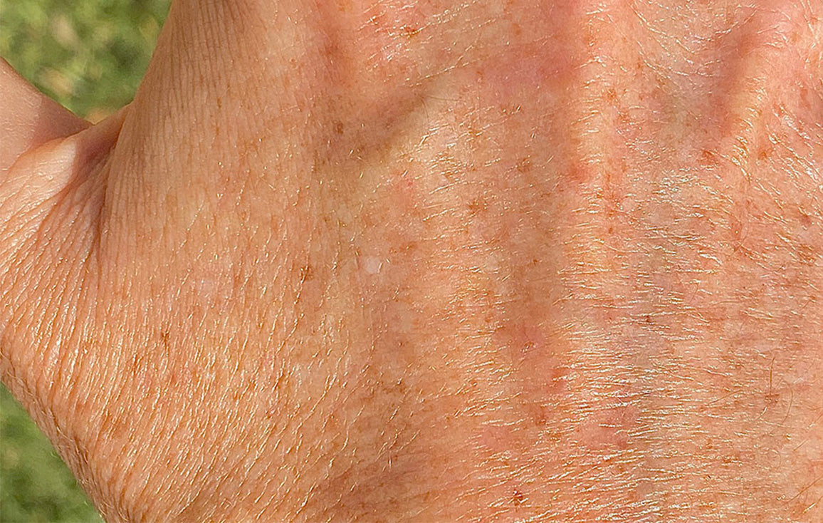 Close up shot of hydrated, smoother hands after using Lanolips' Golden Dry Skin Miracle Salve. Skin appears visibly healthier with reduced dryness and improved texture. Formulated with all-natural lanolin, antibacterial manuka honey and vitamin e to deeply condition and restore moisture.